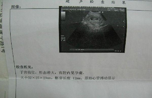 B超单告诉你<em>生男</em>还是<em>生女</em>_圈子话题_快速问医