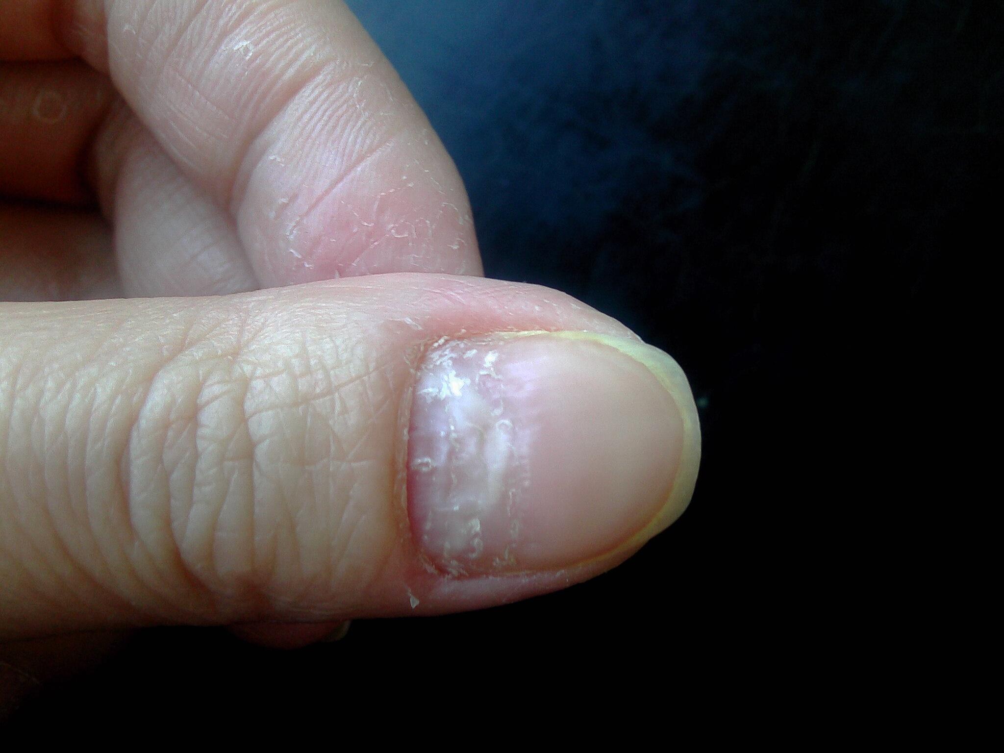 手指指关节略粗大皱纹略明显的手应该如何美化？ - 知乎