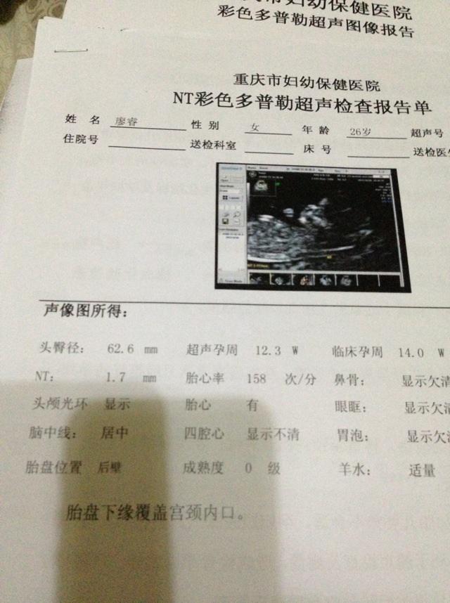 0cm胚芽1.0cm.10月30号检查头臀径62.6mm.临床孕周14w.超声孕周12.3w.