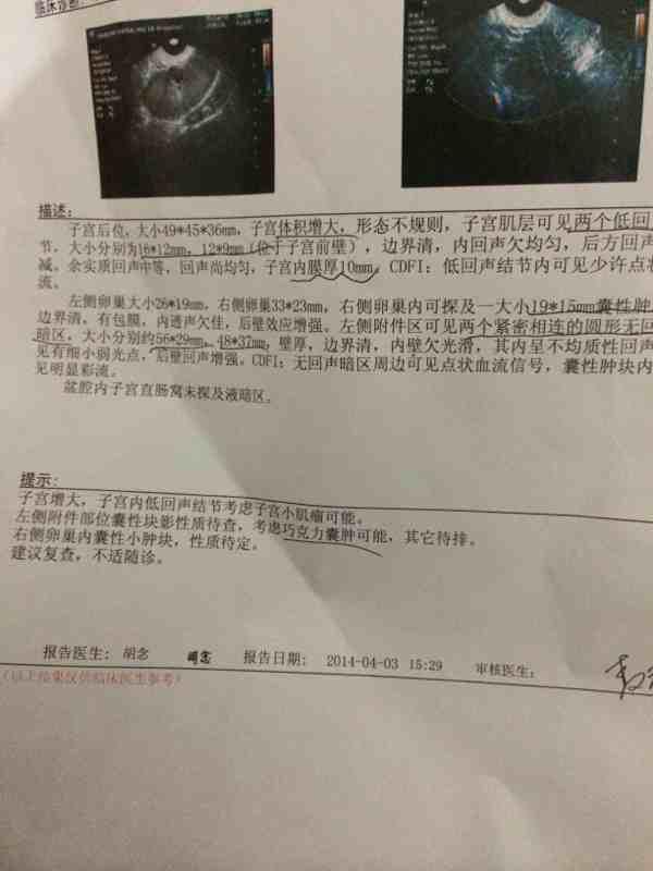 巧克力囊肿会怀不上宝宝吗