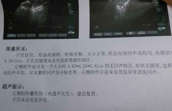 20130604134707_846_thumb.jpg