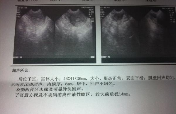 20130917211920_587_thumb.jpg