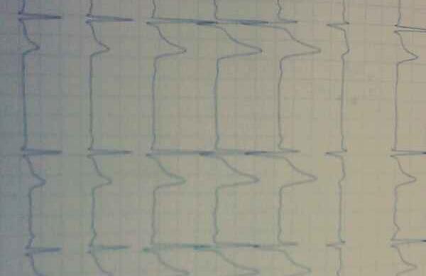 20140321215345_375_thumb.jpg
