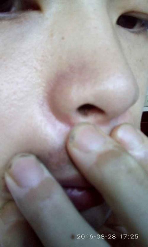 20160828172630144_big.jpg